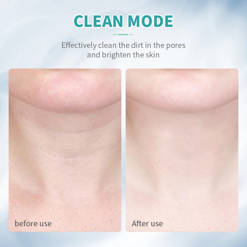 Facial Neck Lifting 3 Colors